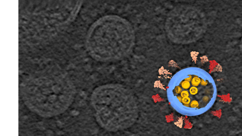 Cryo-electron tomography image of SARS-CoV-2 viruses, in gray, with a computer reconstruction of one virus.